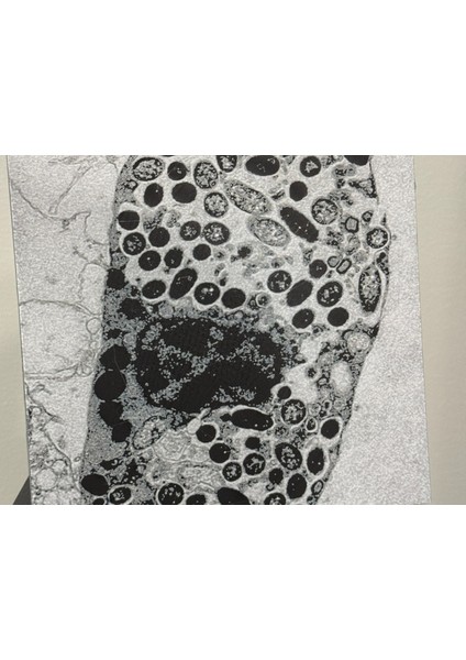 Bir Fagositik Hücre Içinde Legionella Pneumophila (Özelleştirilebilir Tasarım)