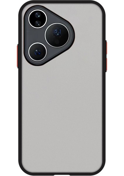 Huawei Pura 80 London Serisi Darbeye Dayanıklı Kılıf - Siyah AL3415