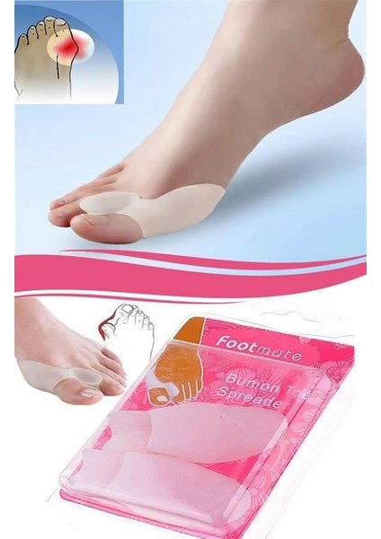 Makaralı Ayak Bunyon Koruyucu (2 Adet) V24