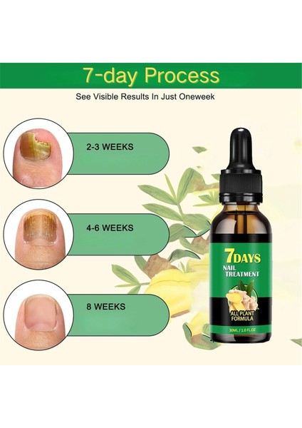 Zencefil Tırnak Bakımı, Çok Amaçlı Tırnak Onarımı, Tırnak Besleyici Yağ Güçlendirici Yağ Essence Zence Tırnak Uzatma Yağı (Yurt Dışından) indirimleri