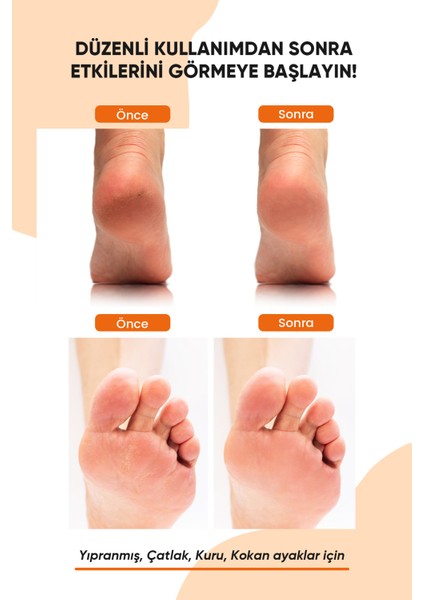 Topuk Çatlak ve Ayak Bakım Peeling Spreyi - Koku Giderici ve Nemlendirici Foot Care Spray 250ML fiyatları