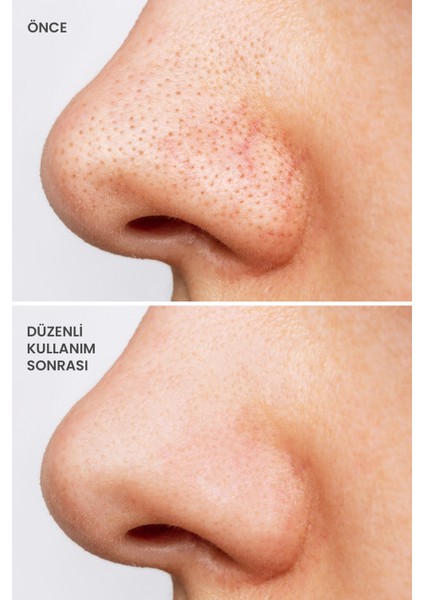 Kolajen Kil Maskesi - Leke ve Siyah Nokta Giderici Yüz Maskesi Collagen Clay Mask 125G fırsatları