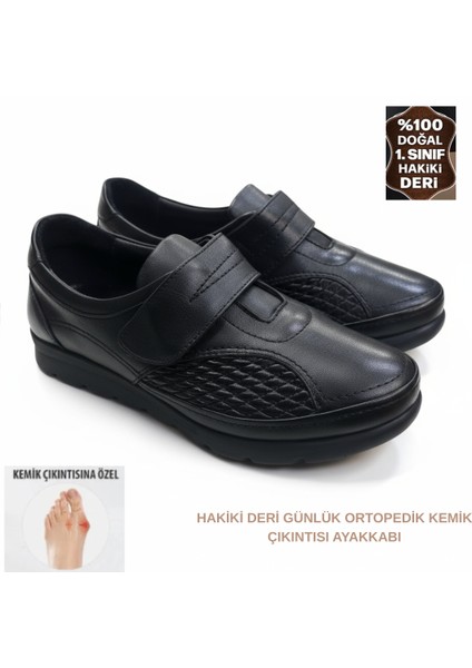 Tam Ortopedik Hakiki Deri Çift Taraflı Kemik Çıkıntısı Anne Ayakkabısı