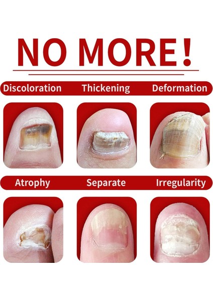 Zencefil Tırnak Bakımı, Çok Amaçlı Tırnak Onarımı, Tırnak Besleyici Yağ Güçlendirici Yağ Essence Zence Tırnak Uzatma Yağı (Yurt Dışından) modelleri