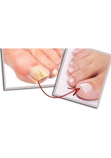 Mantar Serumu Ayak ve Tırnak Serumu fiyatları