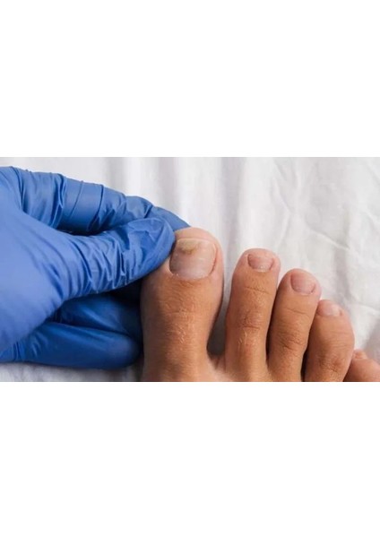 Mantar Serumu Ayak ve Tırnak Serumu modelleri