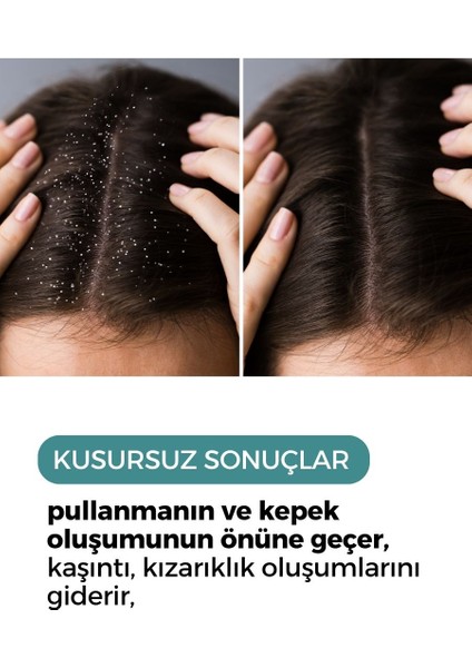 Haır Scalp Antı Dandruff Kepek Şampuanı 250 ml fiyatları