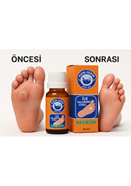 Ayak Bakım Sökücü Solüsyon İlk Kullanımda Etkili 1 Çift 20 ml