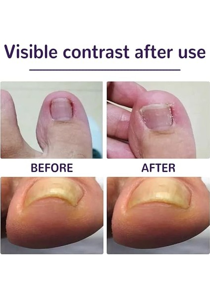 Tırnağı Düzeltme Bandı Adet fiyatları