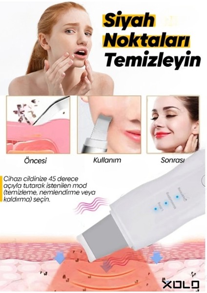 Hipersonik Titreşimli Spatula Siyah Nokta Yüz Temizleme Cihazı