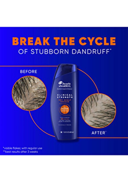 Clinical Strength Şampuan Kepek Önleyici Etkiyle 400 ml Tüm Saçlar İçin