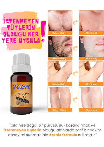 Doğal Tüy Azaltıcı Yağ Seti, Limon ve Karınca Yumurtası Içeriği, 3'lü Paket