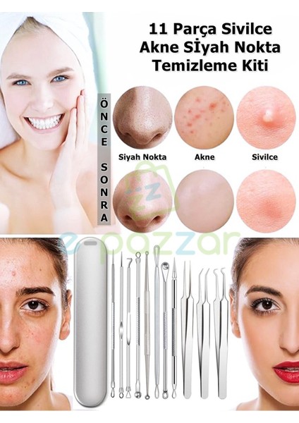 11 Parça Çelik Profesyonel Siyah Nokta Çıkartıcı ve Cımbızlı Set