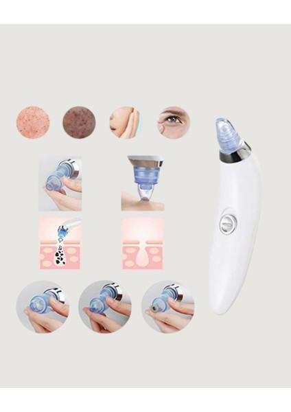 Vakum Teknolojili Siyah Nokta Temizleyici Cihaz – 4 Farklı Başlık ve Derinlemesine Gözenek Temizliği fırsatları