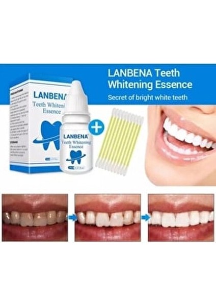 Diş Temizleme Tartar Lekesi Giderici 10 ml Diş Beyazlatma Etkisiyle