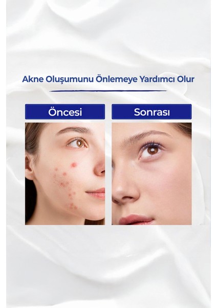 Gece Bakım Kremi - Tüm Cilt Tipleri için A Vitamini ve Retinol ile Yaşlanma Karşıtı Etki indirimleri