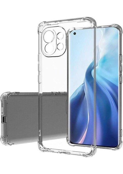 Xiaomi Mi 11 Lite Kılıf Senk Kamera Korumalı Nitro Anti Shock Silikon-Renksiz
