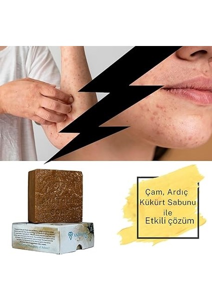 Ardıç Katranı Kükürt Sabunu Özel Üretim Egzama Mantar, Sivilce,kaşıntı,uyuz fırsatları