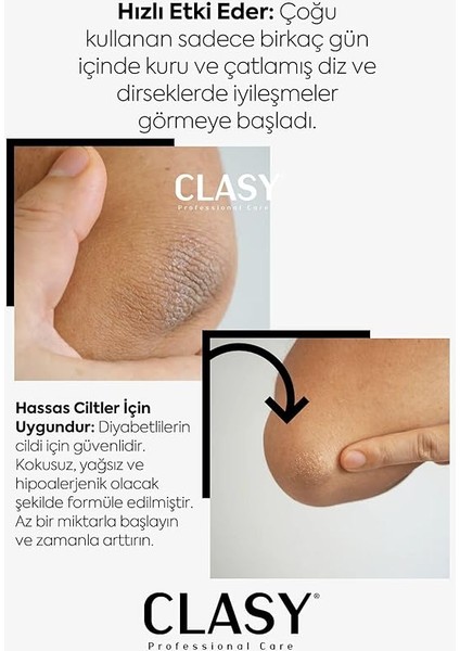 Care El, Diz ve Dirsek Bakım Kremi - Çatlamış, Kurumuş, Koyulaşmış Sert Deriye Karşı indirimleri