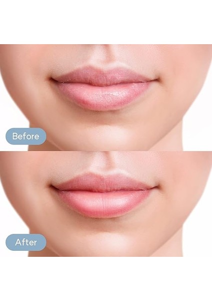 Mango Honey Dudak Bakım Maskesi 10 G indirimleri