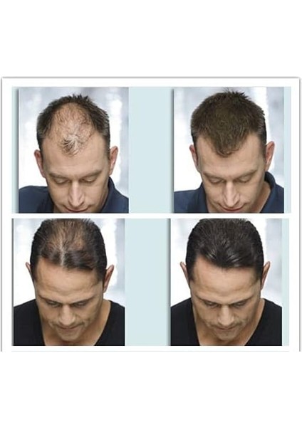 Dolgunlaştırıcı Saç Fiber Tozu 100 gr Siyah fırsatları