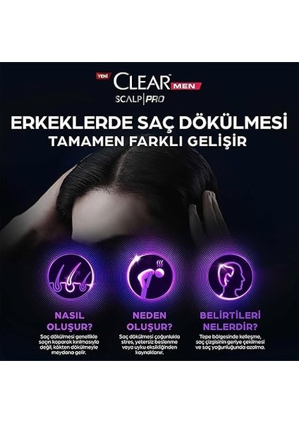Men Scalp Pro Güçlendirici Serum Saç Dökülmesine Karşı 70 ml fırsatları
