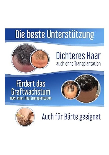 Hair Forte Erkek Saç Dökülmesi Engelleyici Sprey 60 ml indirimleri