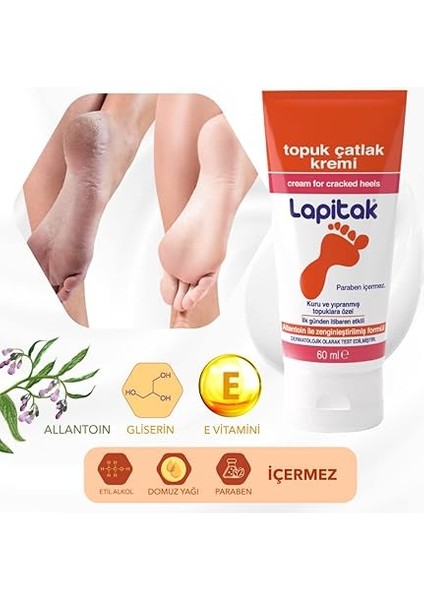 Topuk Çatlak Kremi 60ML - Ayak Kremi - Ayak Bakımı - Ayaklardaki Çatlakları Engenlemeye Yardımcı Olur. Kuru ve Yıpranmış Ayaklarda 24 Saat Içinde Etkisi Hissedilir. indirimleri