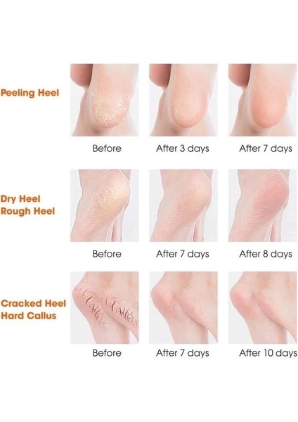 Silikon Topuk Nemlendirici Çorap fiyatları