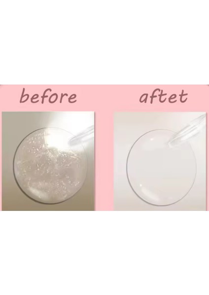 Kontakt Lens Temizleme Kiti Seyahat Taşınabilir Temizleyici