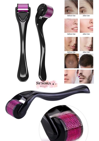 Titanyum Uçlu 540 Iğneli Derma Roller 0,5 mm Cilt Yüz Vücut Saç Yenileme Masaj Aleti