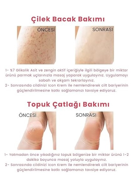 Hydro Solution Babypore Gözenek Sıkılaştırıcı &amp; Canlandırıcı Tonik, %7 Glikolik Asit &amp; Ginseng, Cilt Yenileyici &amp; Arındırıcı, Tüm Cilt Tipleri Için, 200 ml indirimleri