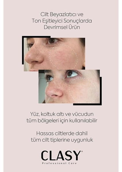 Pigment Düzeltici – Yüzdeki Lekeler Için Krem | Cilt Tonu Eşitleyici &amp; Aydınlatıcı Krem | Koyu Halkalar ve Kızarıklıklar Için Renk Düzeltici – 100 ml fırsatları
