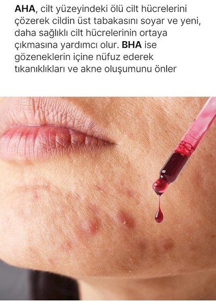 Aha 20% + Bha 2% Canlandırıcı &amp; Cilt Tonu Eşitleyici Kırmızı Peeling Cilt Serum 5 fiyatları