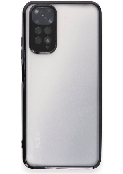 Redmi Note 11S Kılıf Kamera Lens Korumalı Razer Lens Silikon Kapak - Siyah