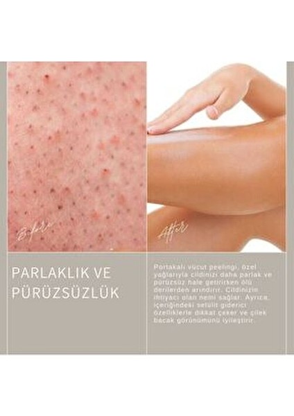 Portakal Vücut Peelingi Çatlak Görünümünü Azaltan 250 gr Yoğun Nem Desteği