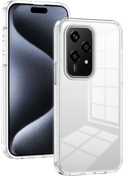 Honor 200 Lite Global Için Akrilik Hibrit Tpu Telefon Kılıfı (Yurt Dışından)