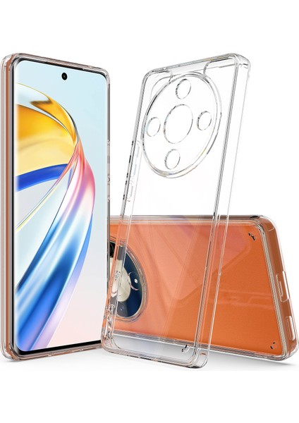 Honor X9B / Magic6 Lite Için Akrilik Tpu Telefon Kılıfı (Yurt Dışından)