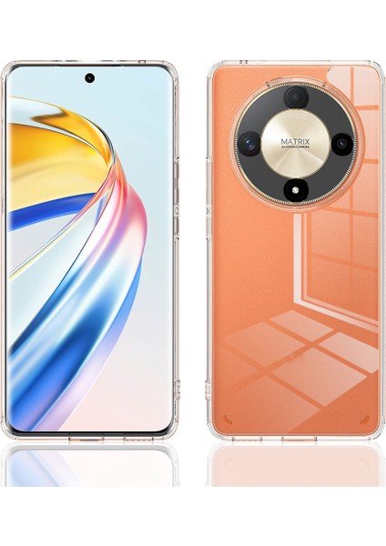 Honor X9B / Magic6 Lite Için Akrilik Tpu Telefon Kılıfı (Yurt Dışından) fiyatları