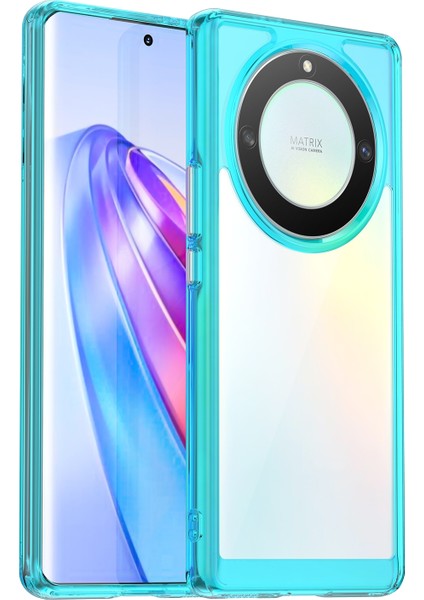 Honor Magic5 Lite Için Akrilik + Tpu Telefon Kılıfı (Yurt Dışından)