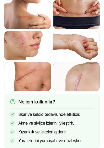 LUOFUCON® Silikon Bant Skar Keloid Estetik Ameliyat İzi Dikiş İz fiyatları