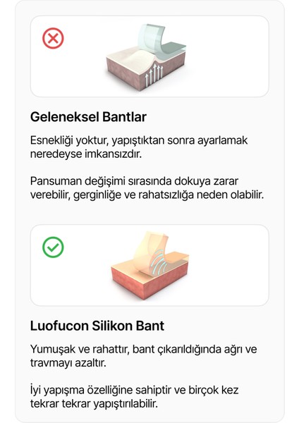 LUOFUCON® Silikon Bant Skar Keloid Estetik Ameliyat İzi Dikiş İz