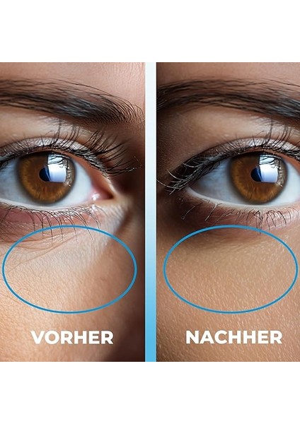 Well Buz Terapisi,kırışıklık Karşıtı Göz Bakım Serumu 10 ml fırsatları