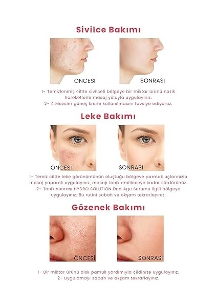 Hydro Solution Babypore Gözenek Sıkılaştırıcı &amp; Canlandırıcı Tonik, %7 Glikolik Asit &amp; Ginseng, Cilt Yenileyici &amp; Arındırıcı, Tüm Cilt Tipleri Için, 200 ml modelleri