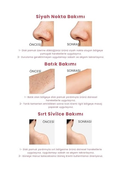 Hydro Solution Babypore Gözenek Sıkılaştırıcı &amp; Canlandırıcı Tonik, %7 Glikolik Asit &amp; Ginseng, Cilt Yenileyici &amp; Arındırıcı, Tüm Cilt Tipleri Için, 200 ml fırsatları