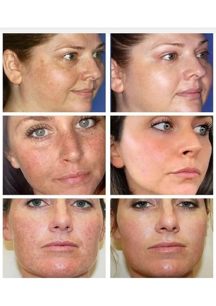 Kanza Cilt Beyazlatıcı, Krem, Sabun ve Serum 3'lü Set fiyatları