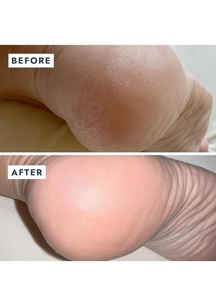 Solemate Topuk Onarıcı Balm 22 Mililitre indirimleri