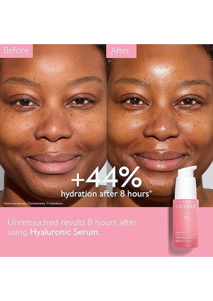 Vinohydra Hiyalüronik Serum 364796 fiyatları