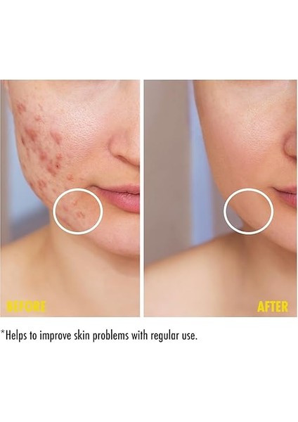 Niacinamide Leke Karşıtı ve Gözenek Sıkılaştırıcı Krem 200 ml fiyatları