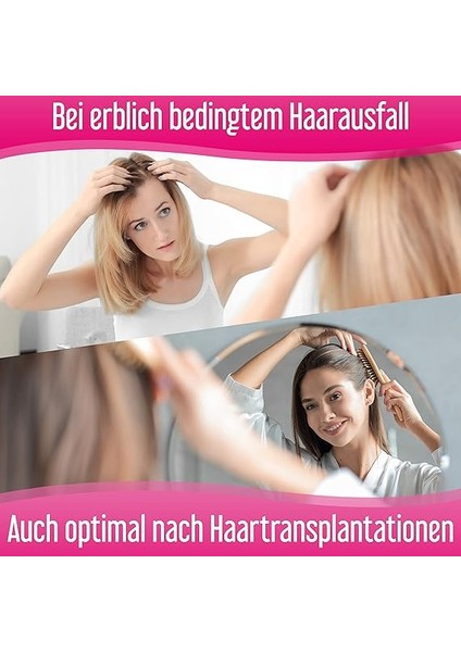 Forte Sprey%2 Procapil Kadınlar Için Saç Dökülmesine Karşı Sprey 60 ml modelleri